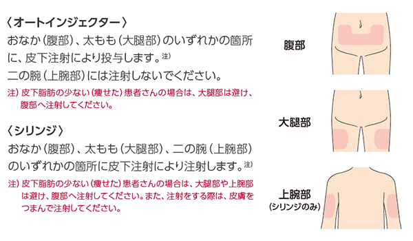 シンポニーを注射する箇所