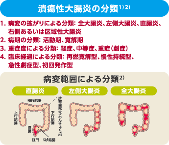 潰瘍性大腸炎の分類