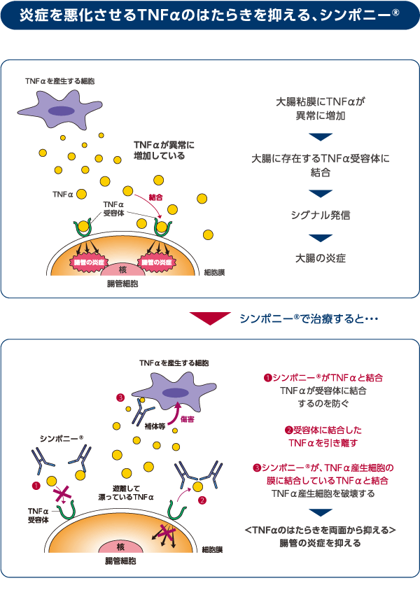 炎症を悪化させるTNAαのはたらきを抑える、シンポニーR