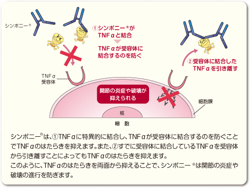 シンポニー®は、①TNFαに特異的に結合し、TNFαが受容体に結合するのを防ぐことでTNFαのはたらきを抑えます。また、②すでに受容体に結合しているTNFαを受容体から引き離すことによってもTNFαのはたらきを抑えます。
このように、TNFαのはたらきを両面から抑えることで、シンポニー®は関節の炎症や破壊の進行を防ぎます。