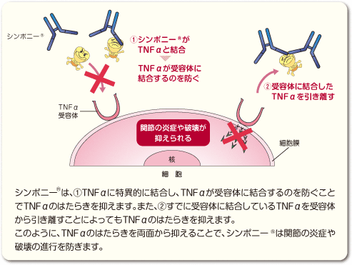 シンポニー®は、①TNFαに特異的に結合し、TNFαが受容体に結合するのを防ぐことでTNFαのはたらきを抑えます。また、②すでに受容体に結合しているTNFαを受容体から引き離すことによってもTNFαのはたらきを抑えます。
このように、TNFαのはたらきを両面から抑えることで、シンポニー®は関節の炎症や破壊の進行を防ぎます。